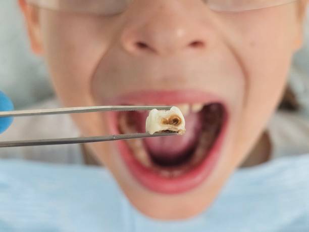 Best Broken Tooth Emergency  in Harrisville, WV